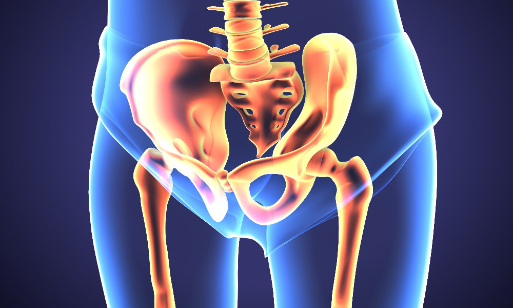 Intervento di protesi d’anca