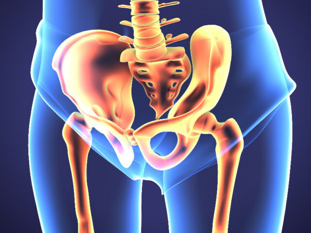 Guida all’intervento di protesi d’anca