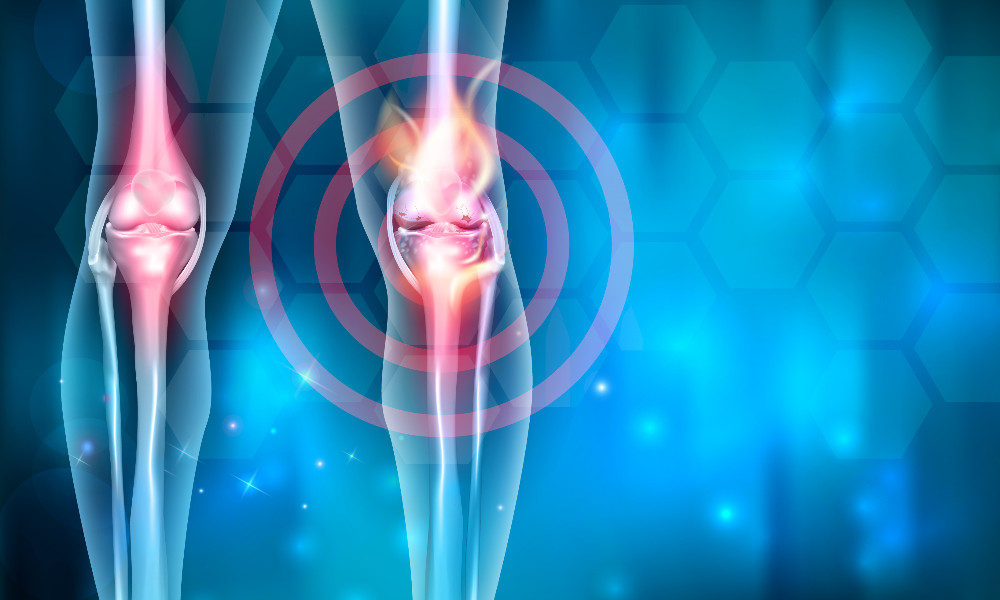 Protesi di ginocchio